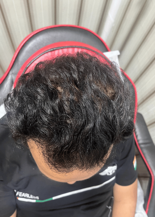 After-3