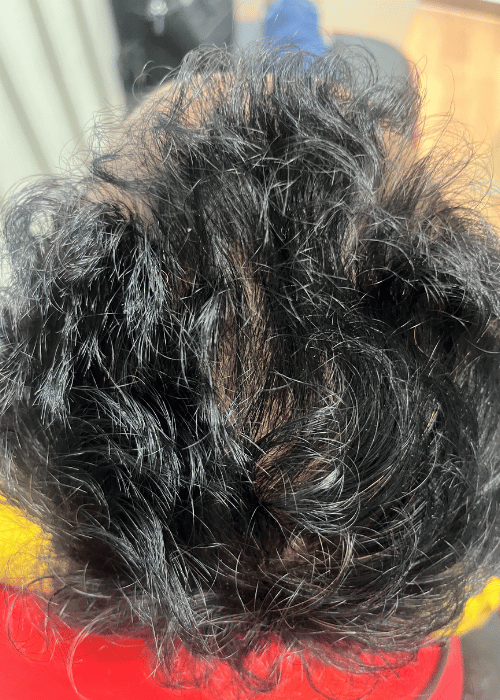 Before-1