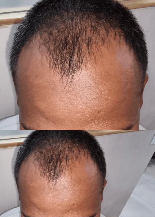 Before-2