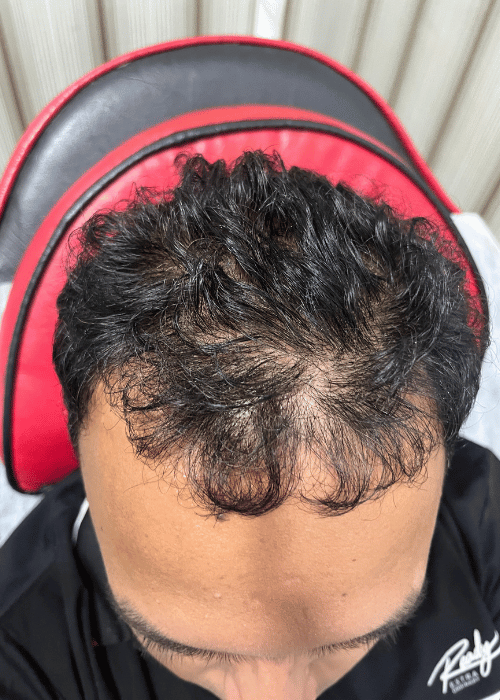 Before-3