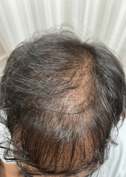 Before-4