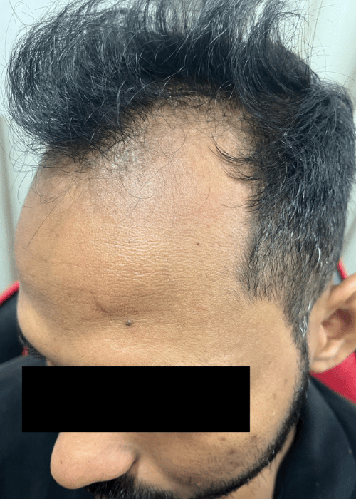 Before-5