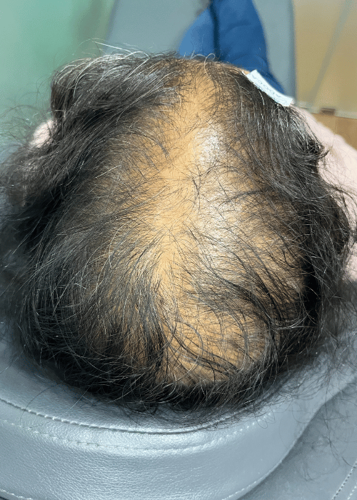 Before-6